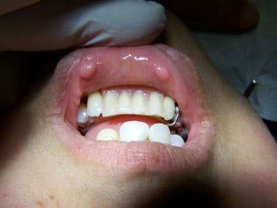 000 0118 o9cf2b - Eugenol