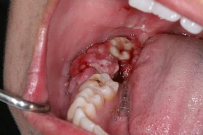 001 mcst5h - Eugenol