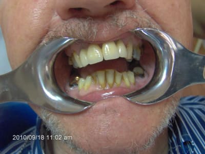 001 wmxal5 - Eugenol