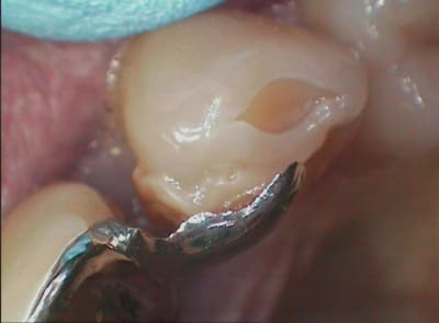 002 fngpqp - Eugenol