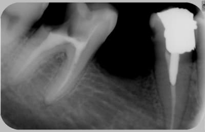 002 hugvgf - Eugenol