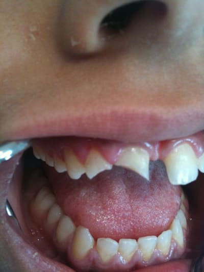 002 kyrafe - Eugenol