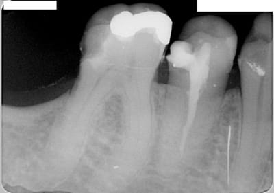 003pr ankjf2 - Eugenol