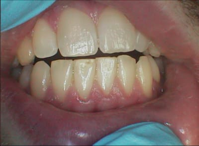 003 kwvf31 - Eugenol