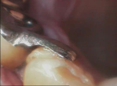 003 lrzpt4 - Eugenol