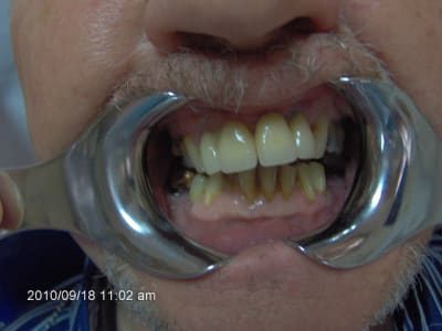 003 nzdc3a - Eugenol