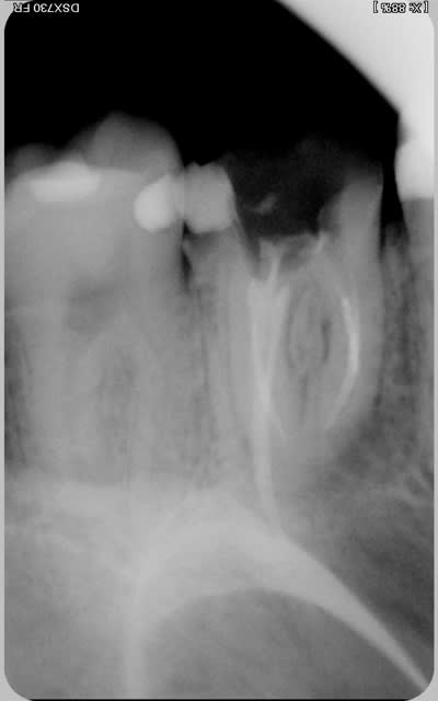 003 s4kwdk - Eugenol