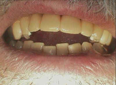 005 mvljcl - Eugenol