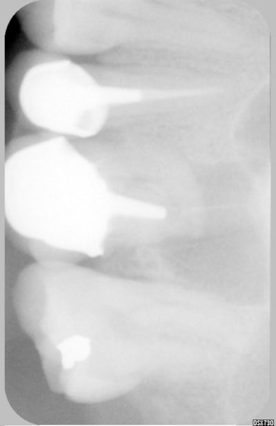 007 ooixai - Eugenol