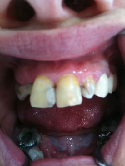 008 tgxzw7 - Eugenol