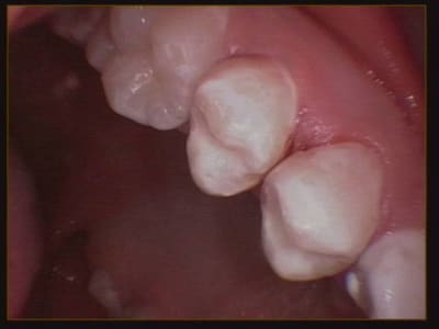 010 cijgf4 - Eugenol
