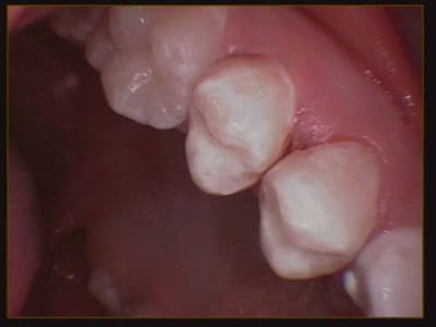 010 mtckme - Eugenol