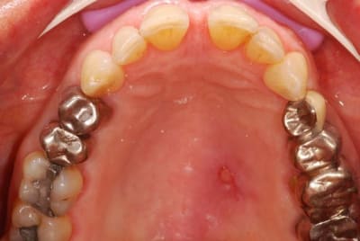 012  800x600  zwvhfa - Eugenol