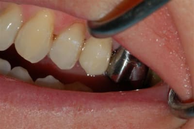 012 qzoqiv - Eugenol