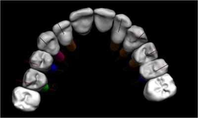 016 guide chirurgical dentaire positdental kcbzpm - Eugenol