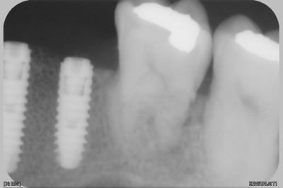 018 e8h3kw - Eugenol