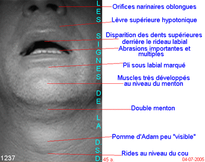 01 signes dsd dtoe5f - Eugenol