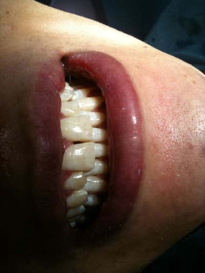 029 o8meyh - Eugenol