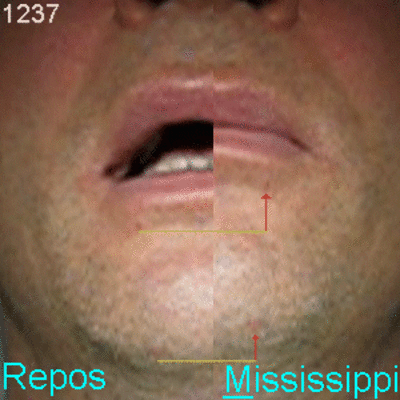 02 repos mississippi lisrq4 - Eugenol