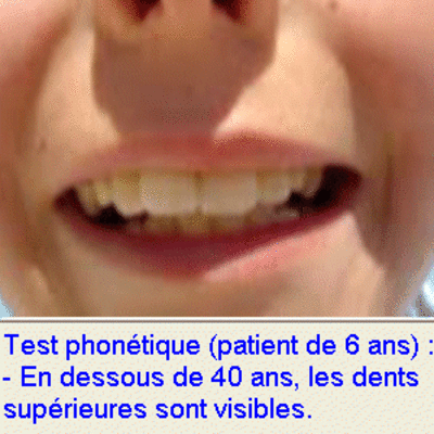 02 test phonetique lejnif - Eugenol