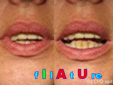 03 f i l a t u re nl7pc4 - Eugenol
