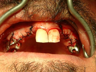 04051305 k4l2r9 - Eugenol