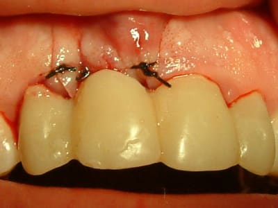 04101408 fqdqz4 - Eugenol