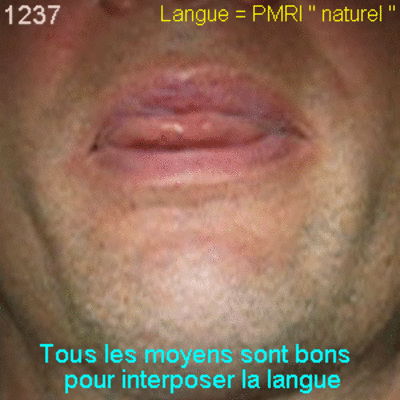 04 intertposition lg fagbmv - Eugenol