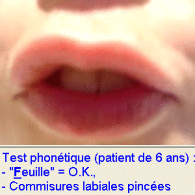 04 test phonetique r9ul6q - Eugenol