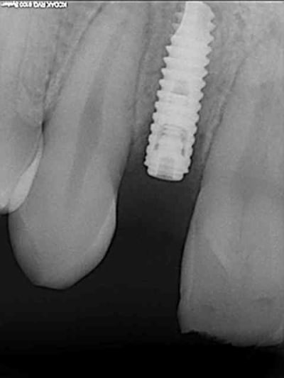 05 10 2009 qif2ab - Eugenol