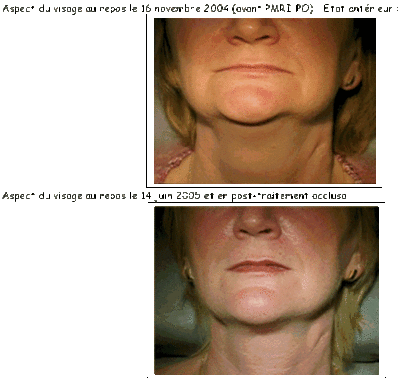 050614 dp bsnn3p - Eugenol