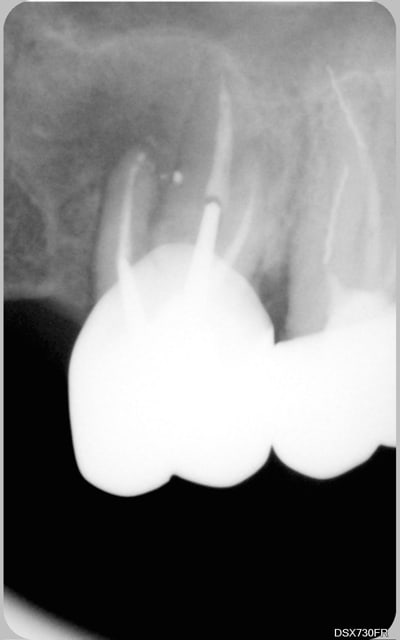 05   17 janvier 2007 efux3r - Eugenol
