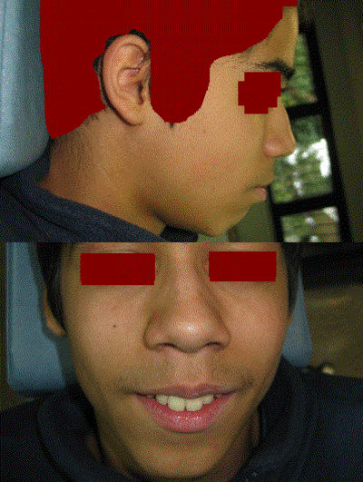 06 face profil akosih - Eugenol