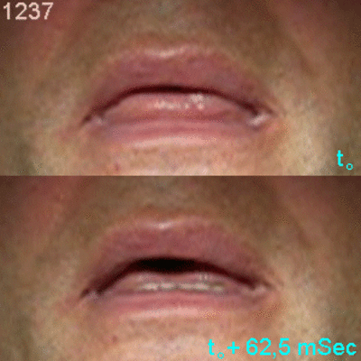 07 interposition lg fhe4so - Eugenol