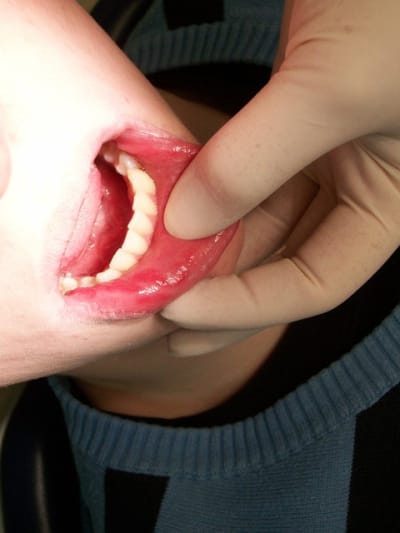 100 0449 antnog - Eugenol