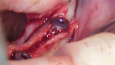 100 0634 rsv7ra - Eugenol