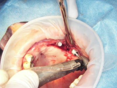 100 4599 ogdlqi - Eugenol