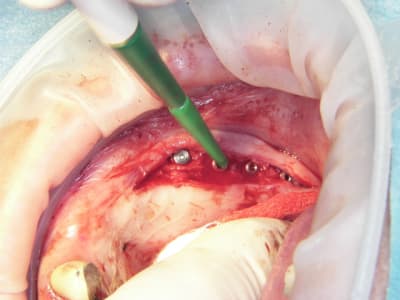 100 4623 nqgxpr - Eugenol