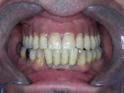 100 5159 dfp785 - Eugenol