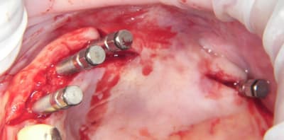 100 5362 yx11tx - Eugenol