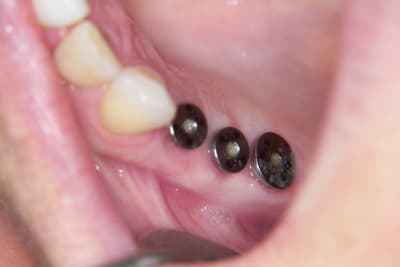 101 1689 mhynto - Eugenol