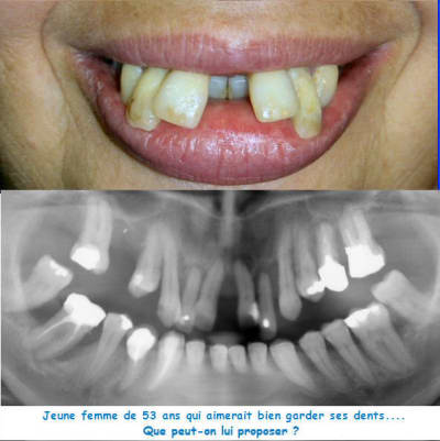 10343 a lvguju - Eugenol