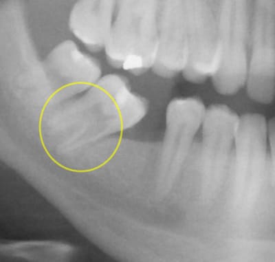 10654 06 06 16 p1bis oq7yng - Eugenol