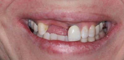 11 12 3 iivy19 - Eugenol