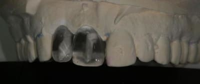 11 12 4 vd6tqe - Eugenol