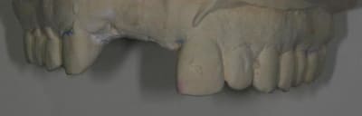 11 12 5 xmnyyj - Eugenol