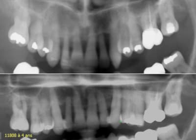 11808 4 ans zzy4cf - Eugenol