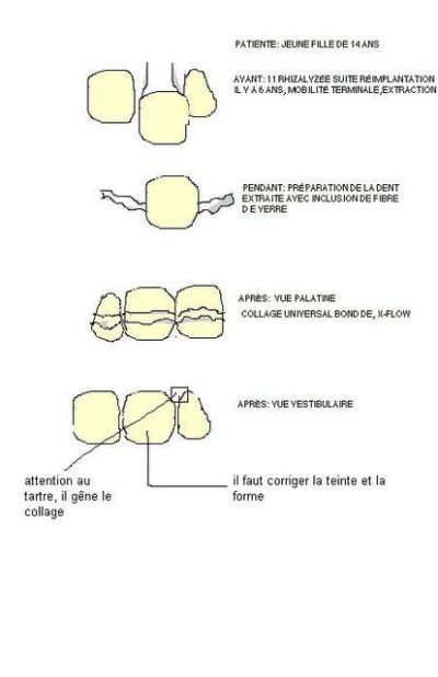 11 extraite  ngvuqx - Eugenol