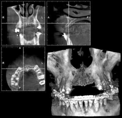 11 avant a rxhzpz - Eugenol