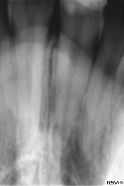 11 fract bis knomkd - Eugenol